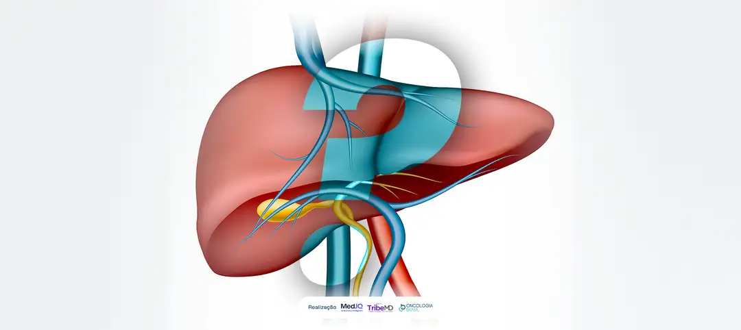Caso clínico destaca desafios e abordagens no colangiocarcinoma avançado