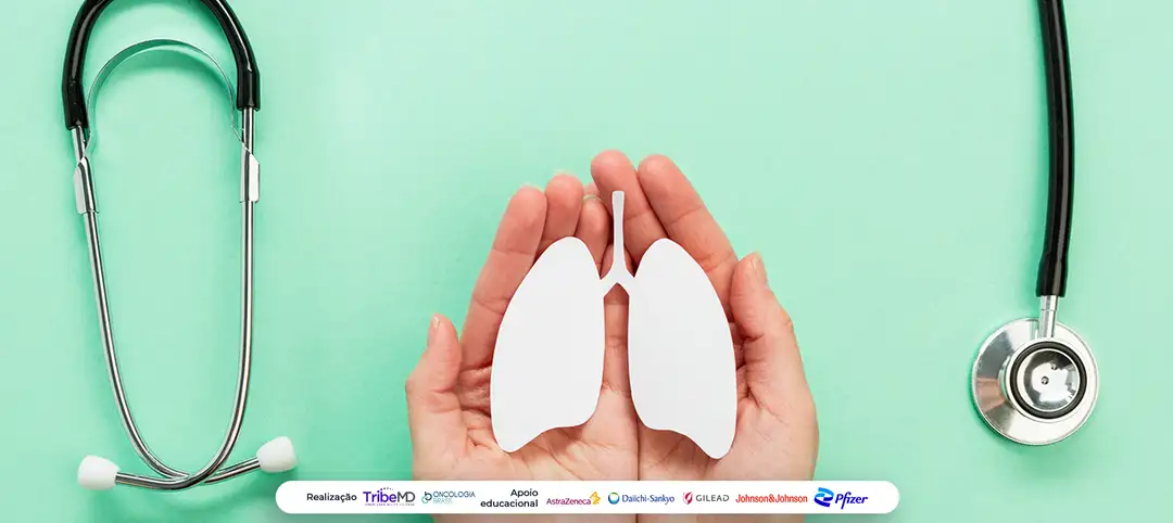 Estudo MDT-BRIDGE aponta avanços no manejo de NSCLC localmente avançado