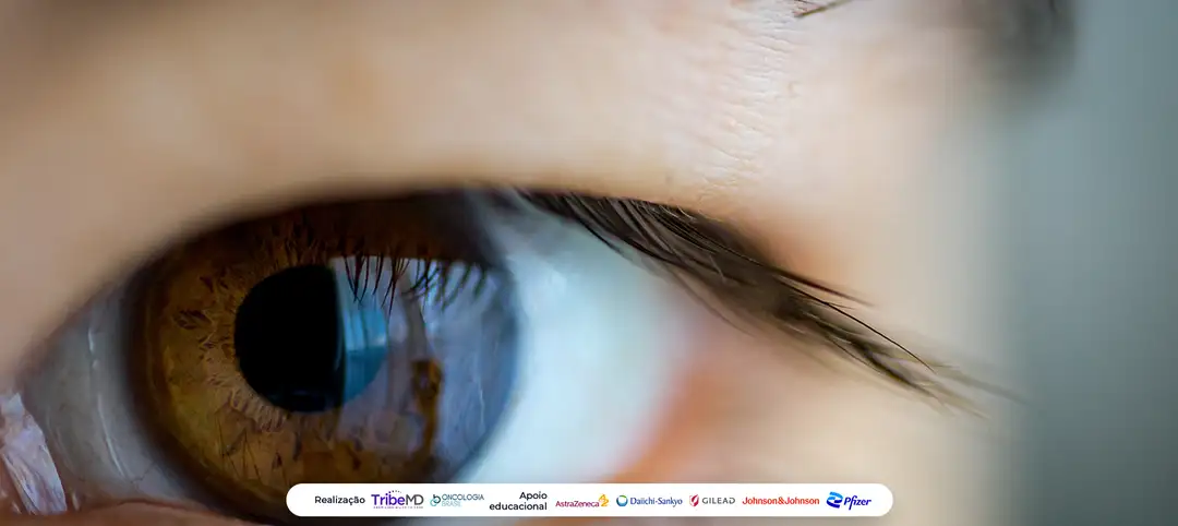 1600O - Eficácia e segurança do IMA203, uma terapia com células T receptoras de antígeno (TCR) direcionada ao PRAME, em pacientes previamente tratados com melanoma uveal avançado ou metastático em um ensaio clínico de fase I.