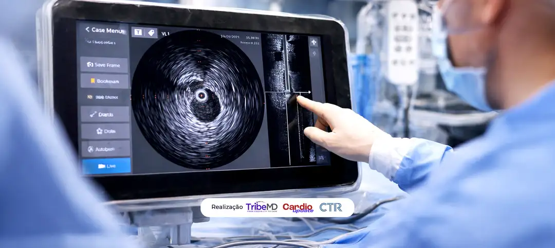 ACC 2026 – IVUS-CHIP: Ultrassonografia intravascular guiada ou angiografia guiada em intervenção coronária percutânea (ICP) complexa de alto risco.