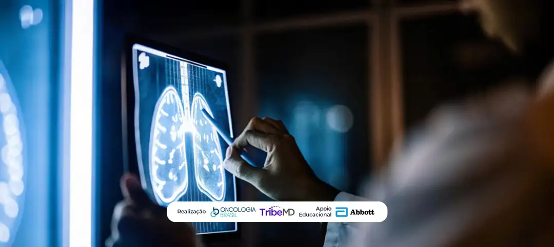 Avanços no câncer de pulmão: novos alvos terapêuticos, imunoterapia e estratégias emergentes em destaque no ELCC