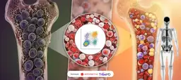 International Myeloma Society propõe definição de cura para o mieloma múltiplo