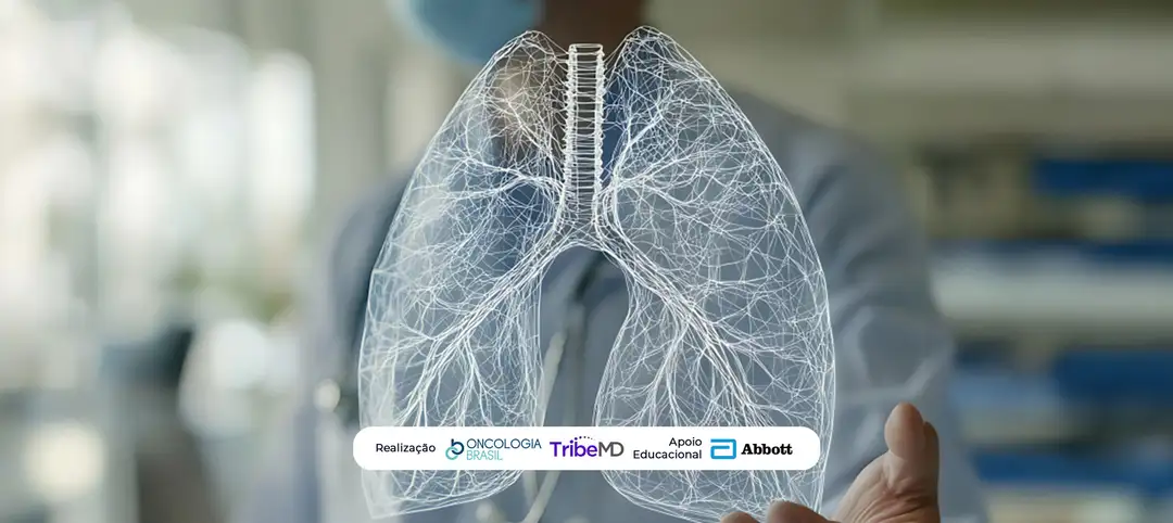 Serplulimabe associado à quimioterapia apresenta resultados promissores no câncer de pulmão de pequenas células