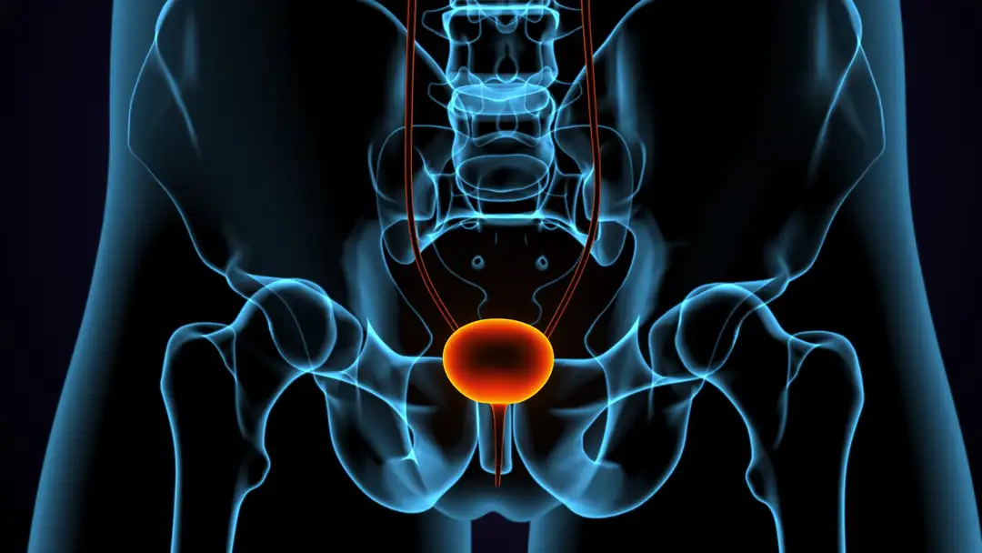 Persistent PSA After Radical Prostatectomy: A Marker of Mortality Risk?