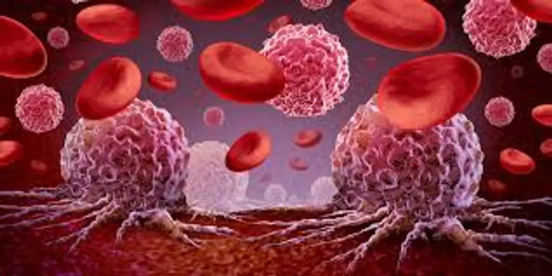 De la biología molecular al tratamiento: medicina de precisión en leucemia mieloide aguda.