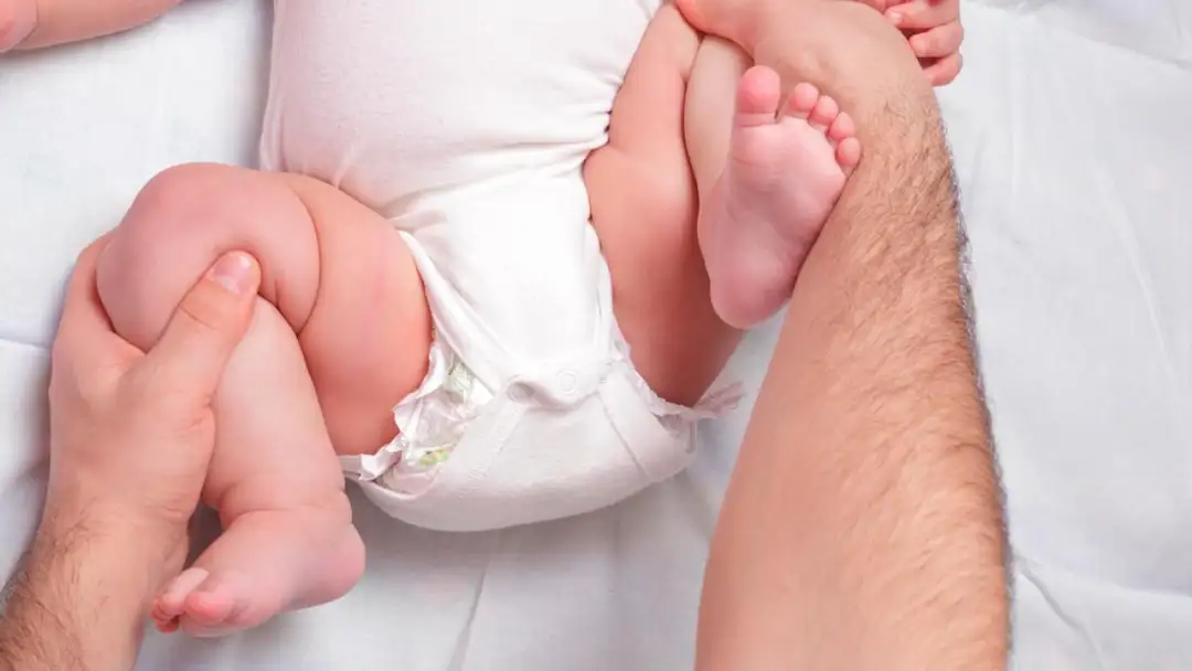 Los expertos advierten que el diagnóstico precoz de la displasia de cadera en niños evita la cirugía.