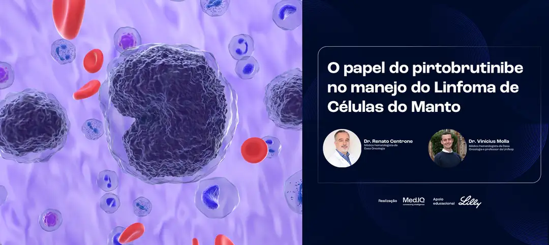 O papel do pirtobrutinibe no manejo do Linfoma de Células do Manto