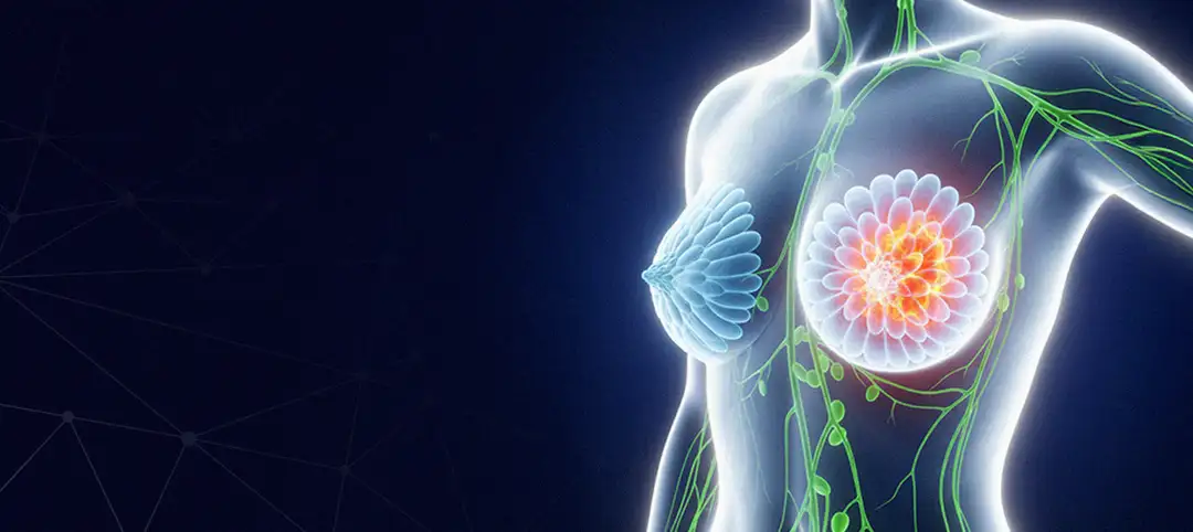 Programa de educação continuada para residentes - A jornada do paciente com câncer de mama