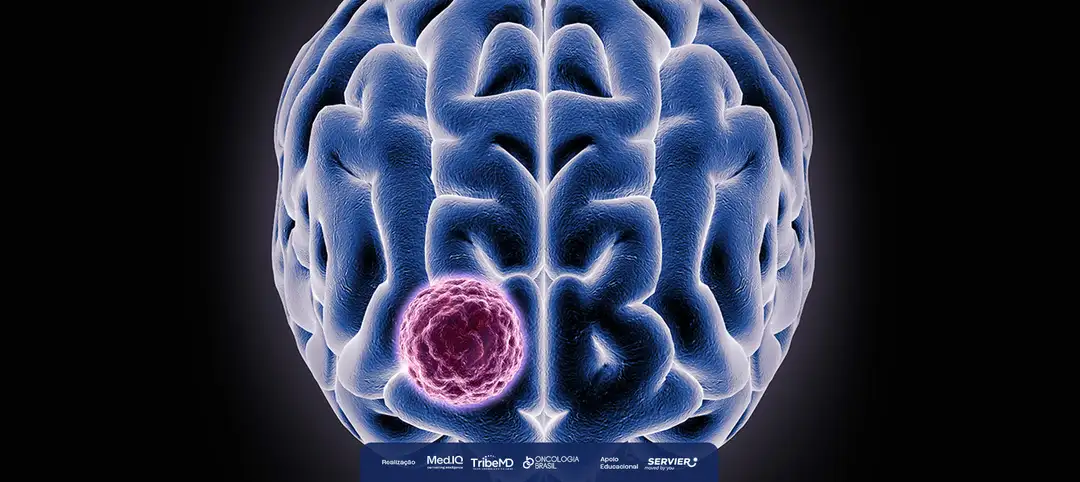 Terapia-Alvo no Glioma Grau 2: Resultados do Estudo INDIGO
