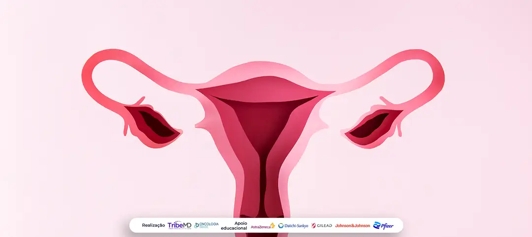 ESMO® 2025: avanços em imunoterapia nos tumores ginecológicos